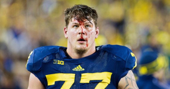 Taylor Lewan